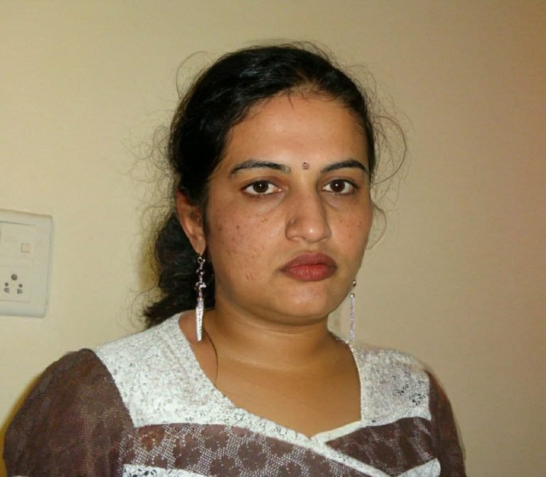 गरीब विधवा हु। त्वचा में बहुत खुजली होती है। क्या करू ?